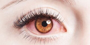 Mỹ phẩm kém chất lượng có thể là thủ phạm gây bệnh cho mắt