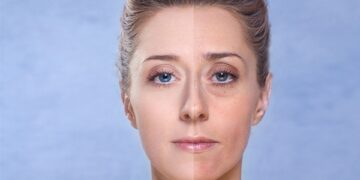 Cách khắc phục làn da xỉn màu, thiếu sức sống