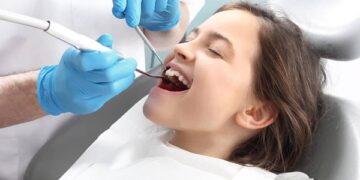 Lợi ích của niềng răng thẩm mỹ