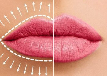 Môi mỏng đi có phải là dấu hiệu của lão hóa?