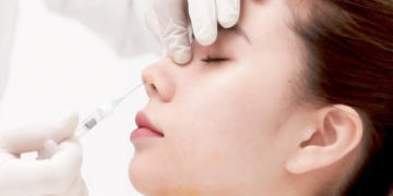 Có nên tiêm filler nâng mũi không?
