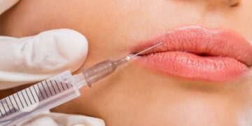 4 nguyên nhân dẫn đến biến chứng khi tiêm filler làm đẹp