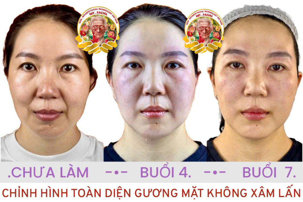 master tran hong tri bieu tuong cong nghe tham my tu nhien tai gio to nganh phun xam giai dau mo rong mua 4